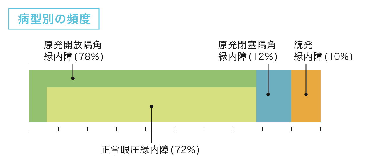 巨大乳頭結膜炎 CLなどの機械的刺激によるもの 上眼瞼結膜に巨大乳頭好発