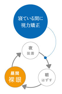 就寝中の近視矯正「オルソケラトロジー」